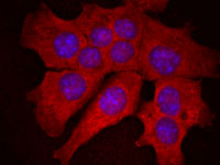 Hepatocytes InSCREENeX offers immortalized murine hepatocytes.